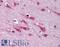 Mitogen-Activated Protein Kinase 9 antibody, LS-B1828, Lifespan Biosciences, Immunohistochemistry paraffin image 