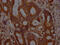 c-met antibody, CSB-RA634199A0HU, Cusabio, Immunohistochemistry paraffin image 