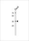 FOS Like 2, AP-1 Transcription Factor Subunit antibody, LS-C166210, Lifespan Biosciences, Western Blot image 