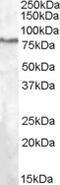 SEL1L Adaptor Subunit Of ERAD E3 Ubiquitin Ligase antibody, TA303359, Origene, Western Blot image 