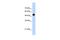 Cyclin D Binding Myb Like Transcription Factor 1 antibody, PA5-40935, Invitrogen Antibodies, Western Blot image 