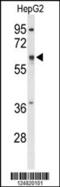 Atlastin GTPase 2 antibody, MBS9216172, MyBioSource, Western Blot image 