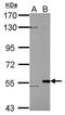 Lysine Acetyltransferase 5 antibody, PA5-34794, Invitrogen Antibodies, Western Blot image 