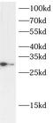 Apolipoprotein D antibody, FNab10736, FineTest, Western Blot image 