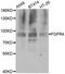 Fibroblast Growth Factor Receptor 4 antibody, LS-C349238, Lifespan Biosciences, Western Blot image 