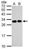 Solute Carrier Family 25 Member 11 antibody, GTX101761, GeneTex, Western Blot image 