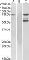 Tyrosine-protein kinase ITK/TSK antibody, 45-784, ProSci, Western Blot image 