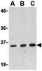 Death Effector Domain Containing 2 antibody, GTX16979, GeneTex, Western Blot image 