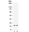 Transthyretin antibody, R31871, NSJ Bioreagents, Western Blot image 