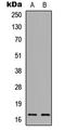 Interleukin 36 Receptor Antagonist antibody, LS-C356123, Lifespan Biosciences, Western Blot image 