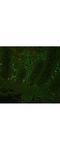 TNF-a antibody, A00002-1, Boster Biological Technology, Immunohistochemistry paraffin image 