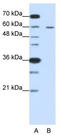 Frizzled Class Receptor 5 antibody, TA344063, Origene, Western Blot image 