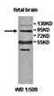 Protocadherin Gamma Subfamily C, 4 antibody, orb77904, Biorbyt, Western Blot image 