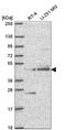 Ethanolamine-Phosphate Phospho-Lyase antibody, NBP2-57397, Novus Biologicals, Western Blot image 