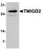 Transmembrane And Immunoglobulin Domain Containing 2 antibody, TA326695, Origene, Western Blot image 