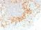 CD27 Molecule antibody, M01148, Boster Biological Technology, Immunohistochemistry paraffin image 