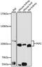 Plakophilin 2 antibody, GTX54579, GeneTex, Western Blot image 