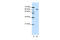 Eukaryotic Translation Initiation Factor 4B antibody, 29-271, ProSci, Western Blot image 