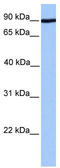 ADAM Metallopeptidase Domain 2 antibody, TA335864, Origene, Western Blot image 