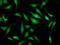 OTU Deubiquitinase 7B antibody, LS-C673969, Lifespan Biosciences, Immunofluorescence image 