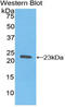 Hemoglobin Subunit Beta antibody, LS-C300912, Lifespan Biosciences, Western Blot image 