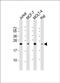 Rho GDP Dissociation Inhibitor Alpha antibody, orb49117, Biorbyt, Western Blot image 