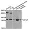 Ubiquitin C-Terminal Hydrolase L3 antibody, A8156, ABclonal Technology, Western Blot image 