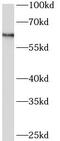 Arylsulfatase D antibody, FNab00617, FineTest, Western Blot image 