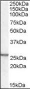 Cysteine And Glycine Rich Protein 2 antibody, orb89725, Biorbyt, Western Blot image 