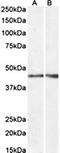 NPHS2 Stomatin Family Member, Podocin antibody, orb131711, Biorbyt, Western Blot image 