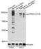 Protein Kinase C Theta antibody, LS-C750604, Lifespan Biosciences, Western Blot image 