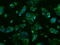 Cytochrome P450 Family 2 Subfamily E Member 1 antibody, GTX84635, GeneTex, Immunofluorescence image 