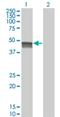 Sphingomyelin Phosphodiesterase Acid Like 3B antibody, H00027293-M01, Novus Biologicals, Western Blot image 