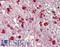 GTPase Activating Protein And VPS9 Domains 1 antibody, LS-B14075, Lifespan Biosciences, Immunohistochemistry paraffin image 