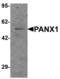 Pannexin 1 antibody, LS-C153735, Lifespan Biosciences, Western Blot image 