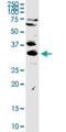 Three Prime Repair Exonuclease 1 antibody, H00011277-D01P, Novus Biologicals, Western Blot image 