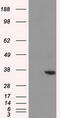 Alcohol dehydrogenase [NADP+] antibody, M04855, Boster Biological Technology, Western Blot image 