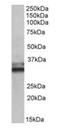 Electron transfer flavoprotein subunit alpha, mitochondrial antibody, orb125023, Biorbyt, Western Blot image 