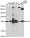 Eukaryotic Translation Initiation Factor 4E antibody, A2162, ABclonal Technology, Western Blot image 
