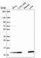 Transmembrane Protein 256 antibody, NBP2-57645, Novus Biologicals, Western Blot image 