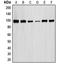 Signal Transducer And Activator Of Transcription 6 antibody, LS-C352896, Lifespan Biosciences, Western Blot image 