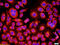 Colony Stimulating Factor 2 Receptor Alpha Subunit antibody, GTX51383, GeneTex, Immunocytochemistry image 