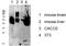 Keratin 8 antibody, STJ99612, St John