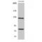 Collagen Type I Alpha 2 Chain antibody, LS-C382804, Lifespan Biosciences, Western Blot image 