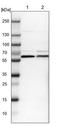 Potassium Voltage-Gated Channel Subfamily A Member 4 antibody, NBP1-89691, Novus Biologicals, Western Blot image 