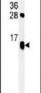 ATP Synthase F1 Subunit Delta antibody, PA5-25860, Invitrogen Antibodies, Western Blot image 