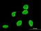 VPS8 Subunit Of CORVET Complex antibody, MA5-24456, Invitrogen Antibodies, Immunofluorescence image 