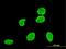 VPS8 Subunit Of CORVET Complex antibody, MA5-24456, Invitrogen Antibodies, Immunofluorescence image 