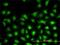 Ubiquitin Conjugating Enzyme E2 L3 antibody, H00007332-M01, Novus Biologicals, Immunofluorescence image 