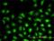 Ubiquitin-conjugating enzyme E2 L3 antibody, H00007332-M01, Novus Biologicals, Immunofluorescence image 